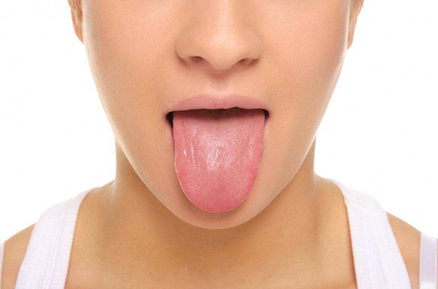 What Your Tongue Says About Your Health?
