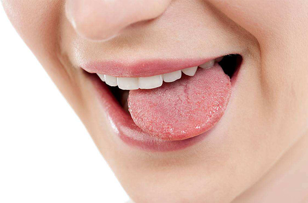 Tongue