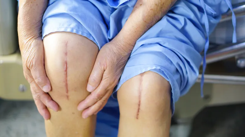 Risks of Delaying Knee Replacement Surgery: See the Answer